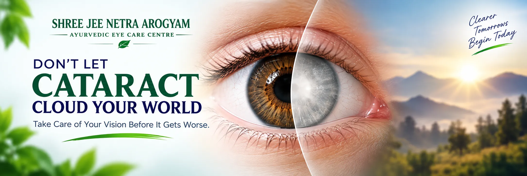 Cataract