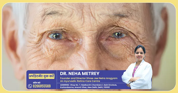 Is Cataract Really Only for Old Age? The Truth Will Surprise You!